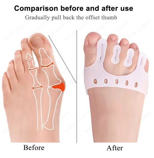 Silicone gel toe separator