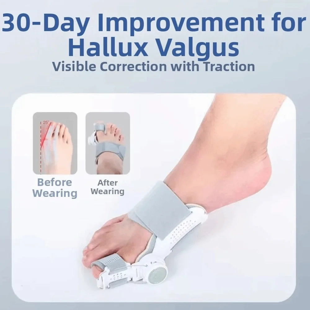 Adjustable Rotatable Bunion Corrector Strap Orthopedic Toe Separator Hallux Valgus